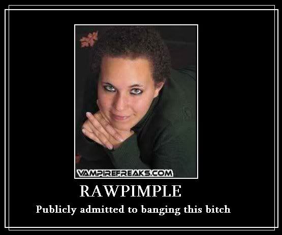 rawpimple-1.jpg