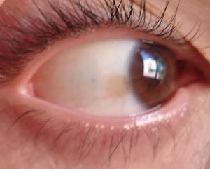 ojo1.jpg