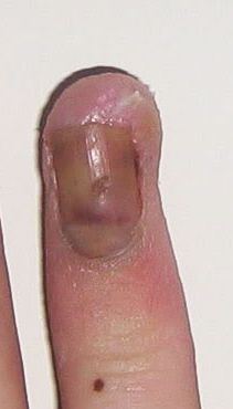 finger11.jpg