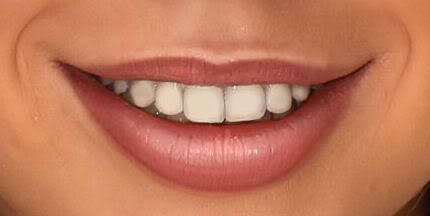 IMAGE: http://i20.photobucket.com/albums/b246/JACKMCENTIRE/TEETH1.jpg
