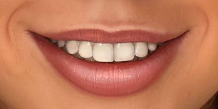 IMAGE: http://i20.photobucket.com/albums/b246/JACKMCENTIRE/TEETH2.jpg